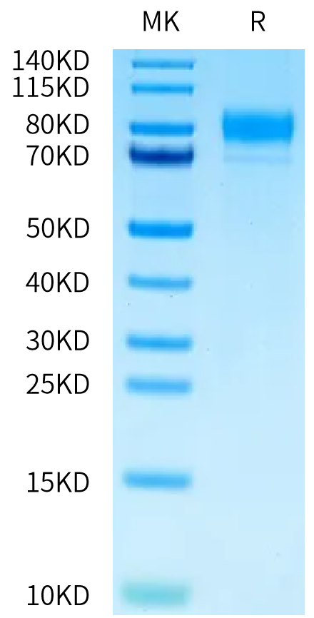 Human M-CSF R on Tris-Bis PAGE under reduced condition. The purity is greater than 95%.Recombinant Human M-CSF R/CSF1R/CD115 Protein, Active