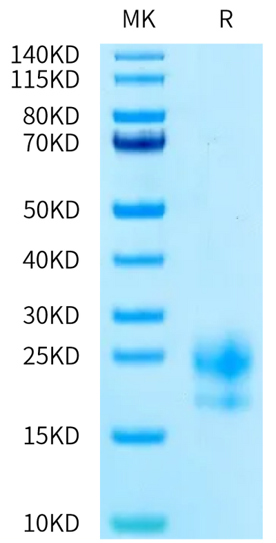 Human CEACAM-3 on Tris-Bis PAGE under reduced condition. The purity is greater than 95%.Recombinant Human CEACAM-3 Protein, Active