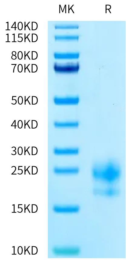 Human CEACAM-3 on Tris-Bis PAGE under reduced condition. The purity is greater than 95%.Recombinant Human CEACAM-3 Protein, Active