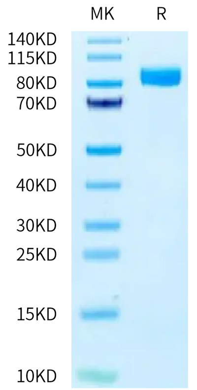 Human CD10 on Tris-Bis PAGE under reduced condition. The purity is greater than 95%.Recombinant Human CD10/MME Protein