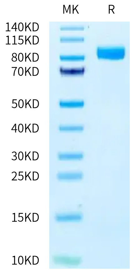 Human CD10 on Tris-Bis PAGE under reduced condition. The purity is greater than 95%.Recombinant Human CD10/MME Protein