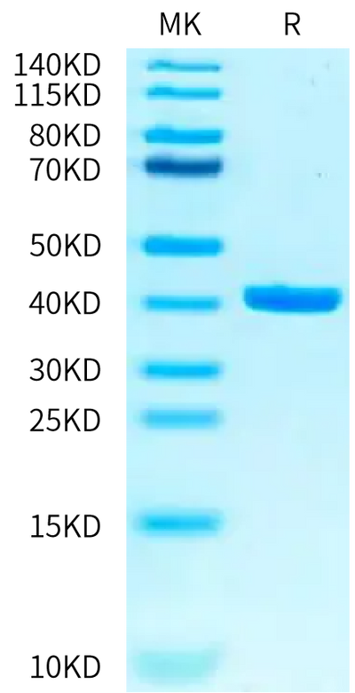Human ITCH on Tris-Bis PAGE under reduced condition. The purity is greater than 95%.Recombinant Human ITCH Protein