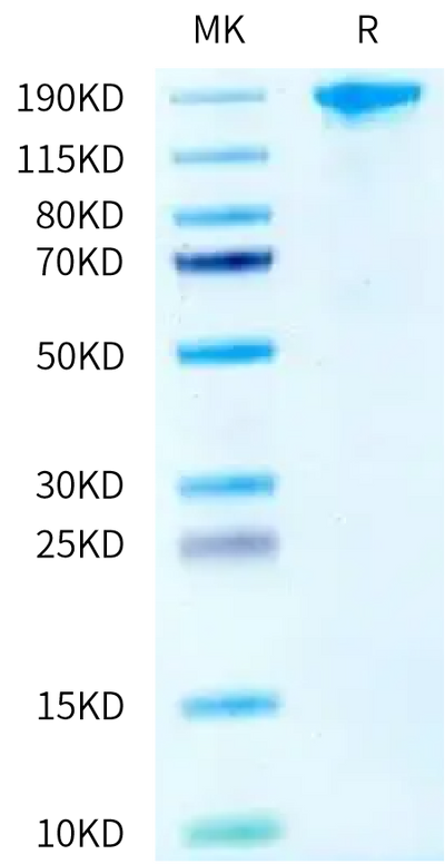 Biotinylated Human SEZ6 on Tris-Bis PAGE under reduced condition. The purity is greater than 95%.Biotinylated Human SEZ6 Protein, Active