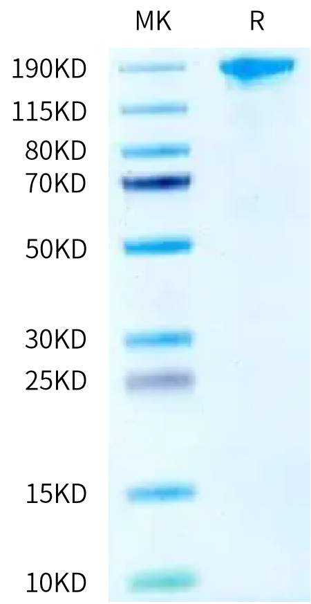 Biotinylated Human SEZ6 on Tris-Bis PAGE under reduced condition. The purity is greater than 95%.Biotinylated Human SEZ6 Protein, Active