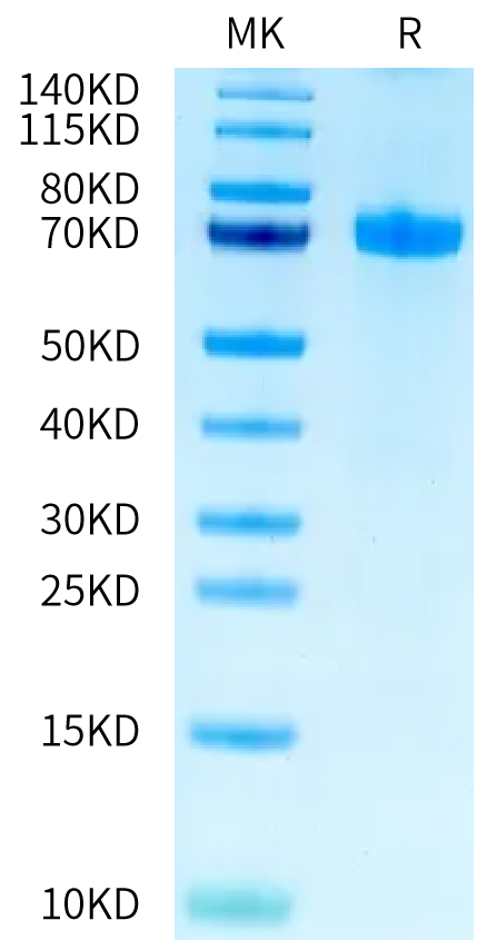 Human Notch 2 on Tris-Bis PAGE under reduced condition. The purity is greater than 95%.Recombinant Human Notch 2 Protein