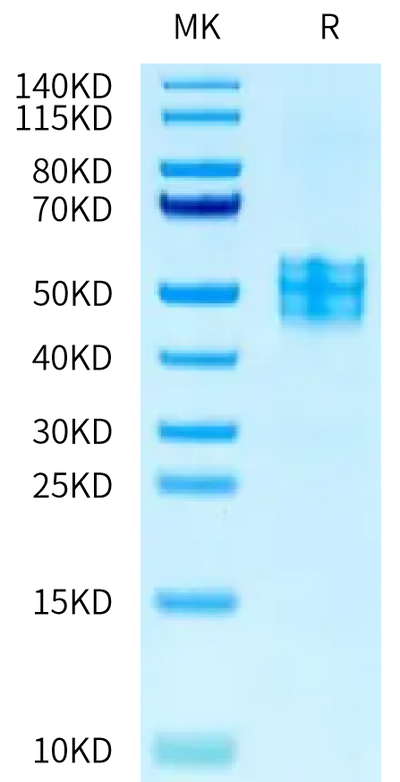 Human VIPR2 on Tris-Bis PAGE under reduced condition. The purity is greater than 95%.Recombinant Human VIPR2 Protein