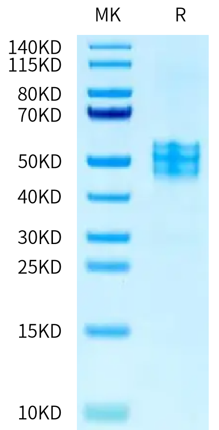 Human VIPR2 on Tris-Bis PAGE under reduced condition. The purity is greater than 95%.Recombinant Human VIPR2 Protein