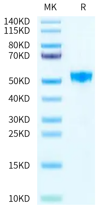 Human TNFSF15 on Tris-Bis PAGE under reduced condition. The purity is greater than 95%.Recombinant Human TNFSF15 Protein, Active