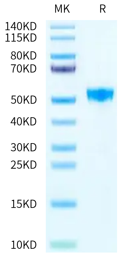 Human TNFSF15 on Tris-Bis PAGE under reduced condition. The purity is greater than 95%.Recombinant Human TNFSF15 Protein, Active