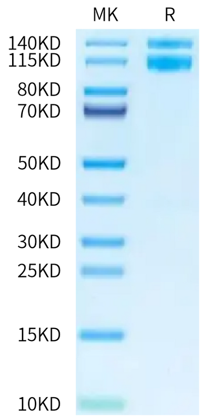 Human ITGAV&ITGB1 on Tris-Bis PAGE under reduced condition. The purity is greater than 95%.Recombinant Human Integrin alpha V beta 1 (ITGAV&ITGB1) Heterodimer Protein, Active