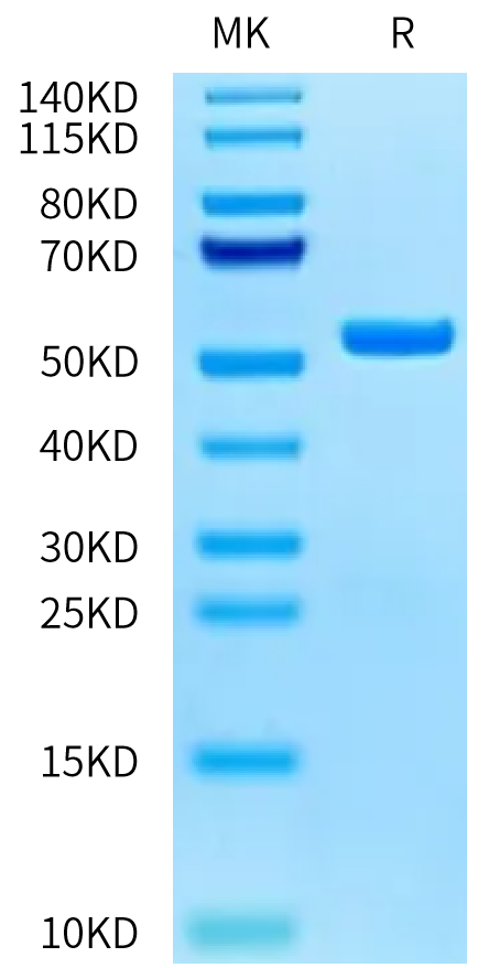 Human ITK on Tris-Bis PAGE under reduced condition. The purity is greater than 95%.Recombinant Human ITK Protein