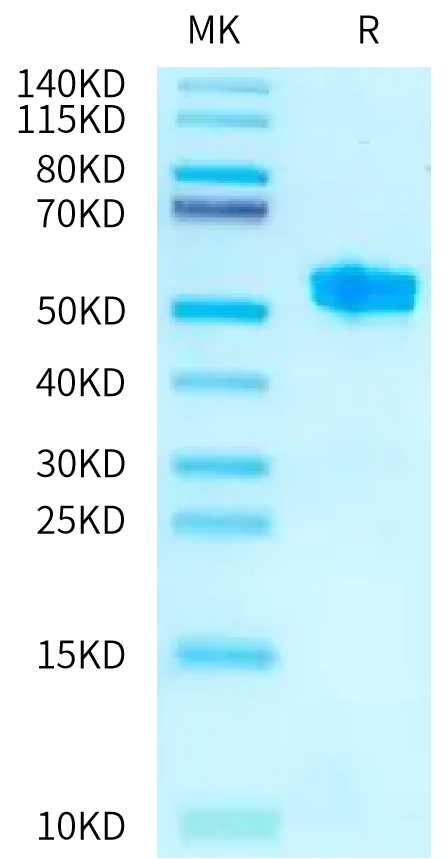 Cynomolgus/Rhesus macaque TNFSF15 on Tris-Bis PAGE under reduced condition. The purity is greater than 95%.Recombinant Cynomolgus/Rhesus macaque TNFSF15 Protein, Active