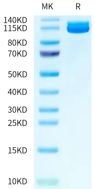 Human ENPP-3 on Tris-Bis PAGE under reduced condition. The purity is greater than 95%.Recombinant Human ENPP-3 Protein