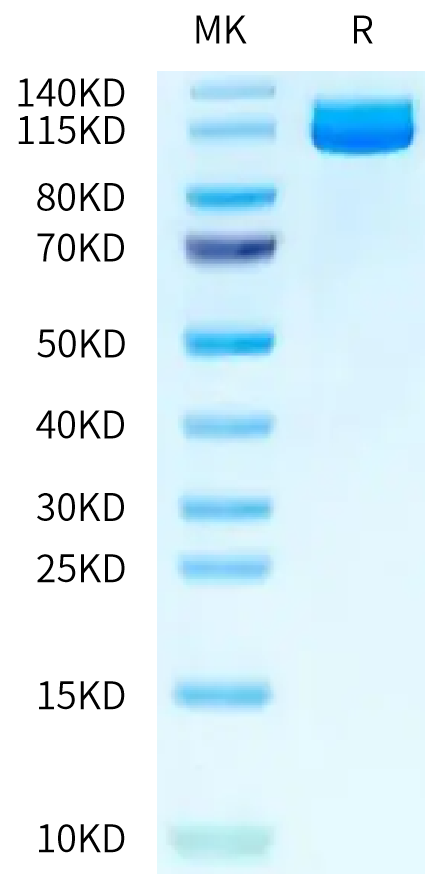 Human ENPP-3 on Tris-Bis PAGE under reduced condition. The purity is greater than 95%.Recombinant Human ENPP-3 Protein