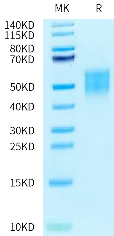 Human CEACAM-7 on Tris-Bis PAGE under reduced condition. The purity is greater than 95%.Recombinant Human CEACAM-7 Protein, Active