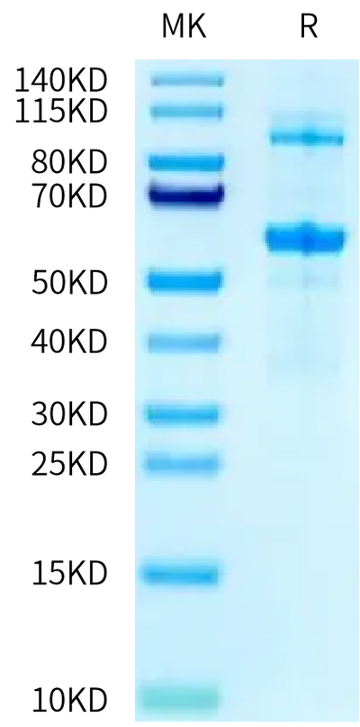 Mouse LOXL2 on Tris-Bis PAGE under reduced condition. The purity is greater than 90%.Recombinant Mouse LOXL2 Protein