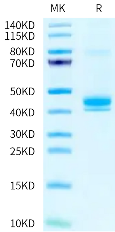 Human CLEC4M on Tris-Bis PAGE under reduced condition. The purity is greater than 95%.Recombinant Human CLEC4M/CD299 Protein