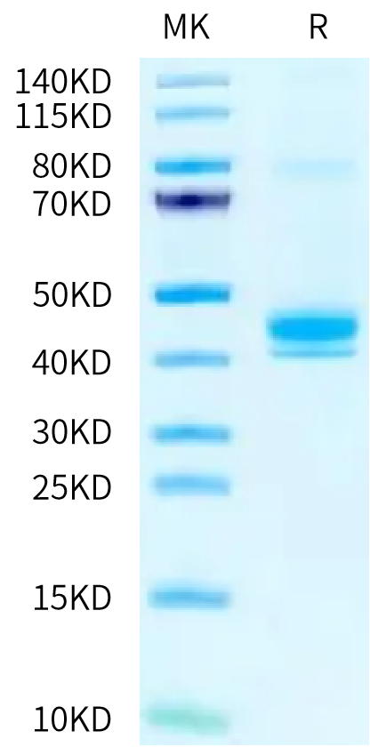 Human CLEC4M on Tris-Bis PAGE under reduced condition. The purity is greater than 95%.Recombinant Human CLEC4M/CD299 Protein