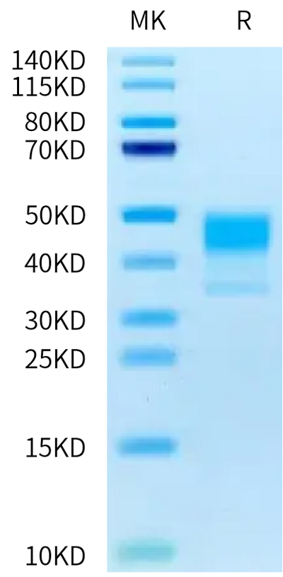 Human MSLN on Tris-Bis PAGE under reduced condition. The purity is greater than 95%.