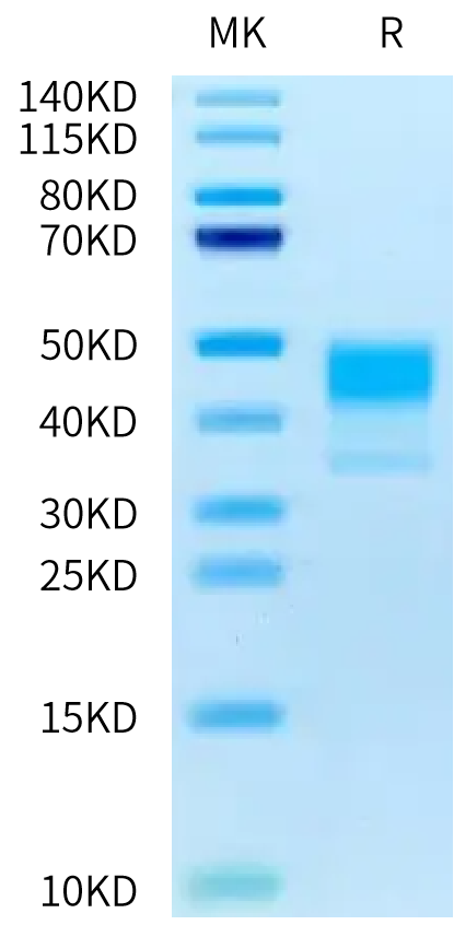 Human MSLN on Tris-Bis PAGE under reduced condition. The purity is greater than 95%.Recombinant Human MSLN/Mesothelin Protein, Active
