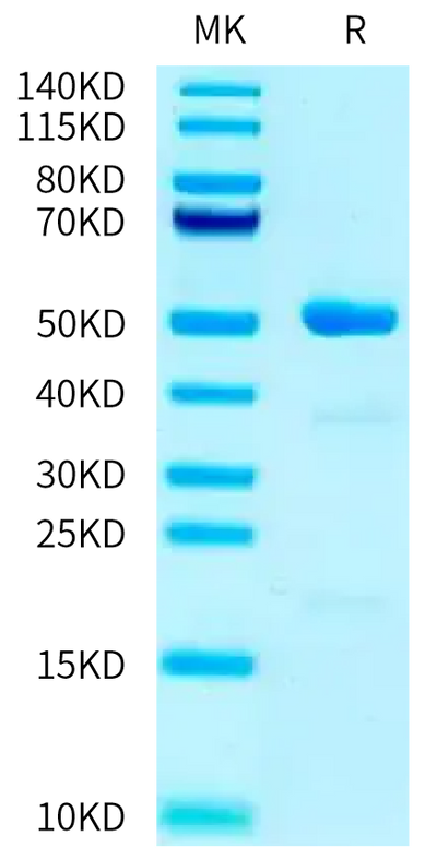Mouse DDC on Tris-Bis PAGE under reduced condition. The purity is greater than 95%.Recombinant Mouse DDC Protein