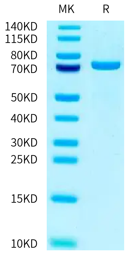 Human TGM3 on Tris-Bis PAGE under reduced condition. The purity is greater than 95%.Recombinant Human TGM3/Transglutaminase 3 Protein