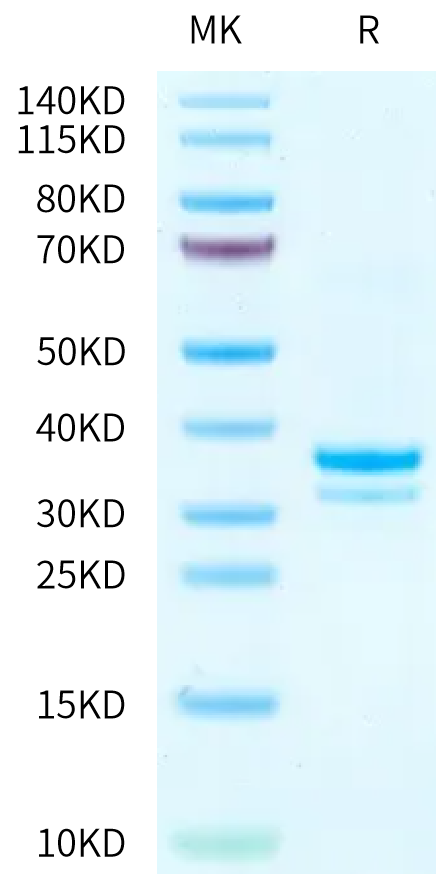 Mouse IgG1 Fc on Tris-Bis PAGE under reduced condition. The purity is greater than 95%.Recombinant Mouse IgG1 Fc Protein, Active