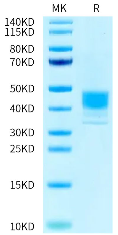 Human MSLN (M593V) on Tris-Bis PAGE under reduced condition. The purity is greater than 95%.