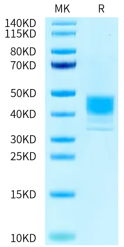 Human MSLN (M593V) on Tris-Bis PAGE under reduced condition. The purity is greater than 95%.Recombinant Human MSLN/Mesothelin (M593V) Protein, Active
