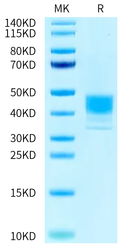 Human MSLN (M593V) on Tris-Bis PAGE under reduced condition. The purity is greater than 95%.Recombinant Human MSLN/Mesothelin (M593V) Protein, Active