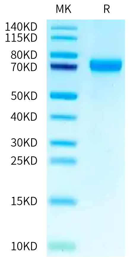 Human CEACAM-7 on Tris-Bis PAGE under reduced condition. The purity is greater than 95%.Recombinant Human CEACAM-7 Protein, Active