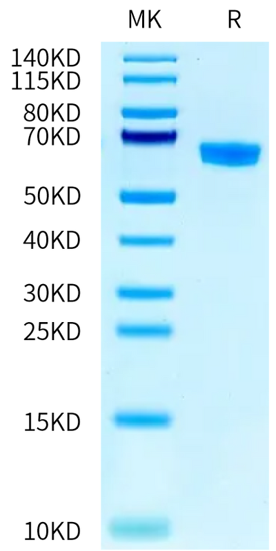 RSV (B) Pre-fusion glycoprotein F0 on Tris-Bis PAGE under reduced condition. The purity is greater than 95%.Recombinant RSV (B) Pre-fusion glycoprotein F0 Protein, Active