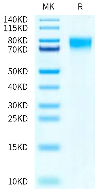 Human SR-BI on Tris-Bis PAGE under reduced condition. The purity is greater than 95%.Recombinant Human SR-BI/SCARB1 Protein
