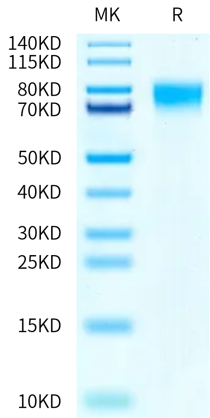 Human SR-BI on Tris-Bis PAGE under reduced condition. The purity is greater than 95%.Recombinant Human SR-BI/SCARB1 Protein