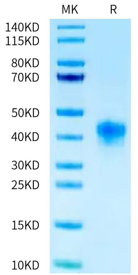 FITC-Labeled Human FOLR1 on Tris-Bis PAGE under reduced condition. The purity is greater than 95%.Recombinant FITC-Labeled Human FOLR1 Protein, Active