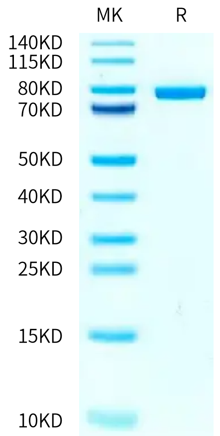 Human STAT4 on Tris-Bis PAGE under reduced condition. The purity is greater than 95%.Recombinant Human STAT4 Protein