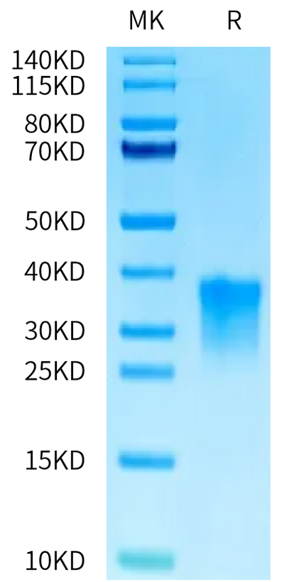 Cynomolgus Oncostatin M on Tris-Bis PAGE under reduced condition. The purity is greater than 95%.Recombinant Cynomolgus Oncostatin M/OSM Protein, Active