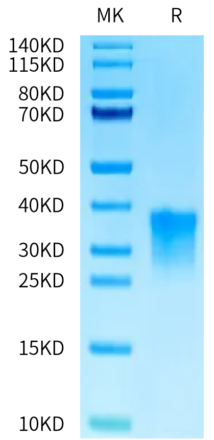 Cynomolgus Oncostatin M on Tris-Bis PAGE under reduced condition. The purity is greater than 95%.Recombinant Cynomolgus Oncostatin M/OSM Protein, Active