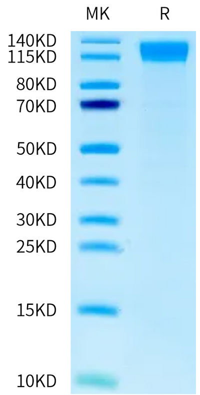 Human OSMR-GPL fusion Protein on Tris-Bis PAGE under reduced condition. The purity is greater than 95%.Recombinant Human OSMR-GPL fusion Protein, Active