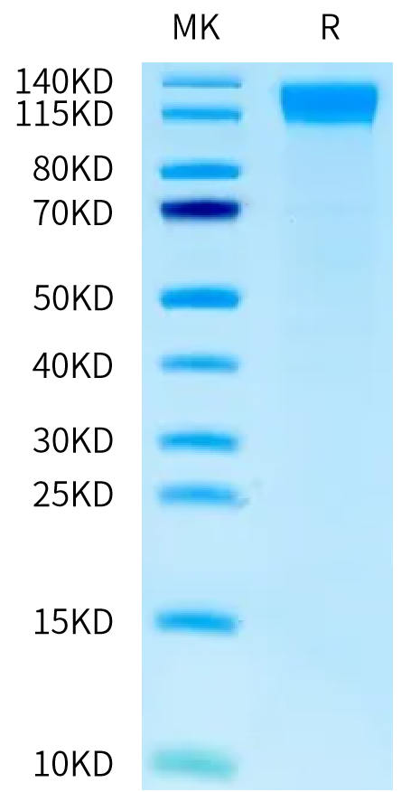 Human OSMR-GPL fusion Protein on Tris-Bis PAGE under reduced condition. The purity is greater than 95%.Recombinant Human OSMR-GPL fusion Protein, Active
