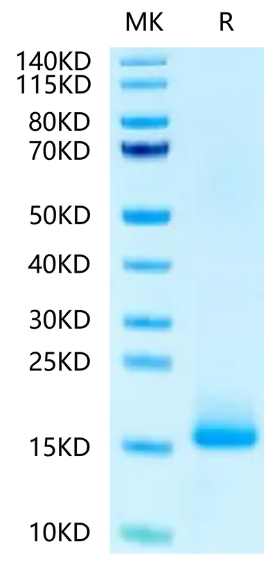 Biotinylated Human LY6G6D on Tris-Bis PAGE under reduced condition. The purity is greater than 95%.Biotinylated Human LY6G6D Protein, Active