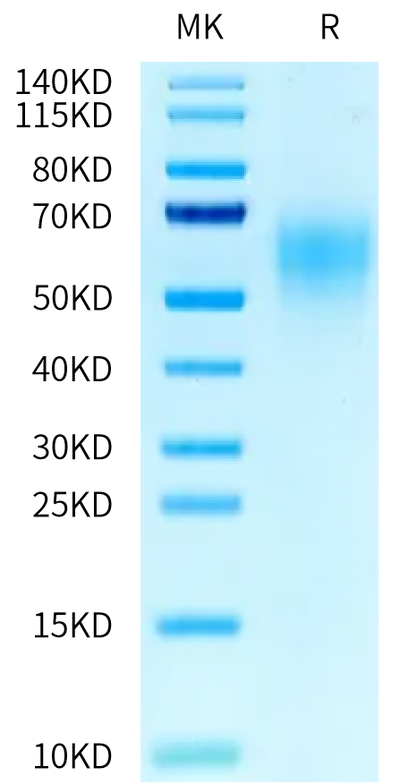 Human CEACAM-5 (501-685) on Tris-Bis PAGE under reduced condition. The purity is greater than 95%.Recombinant Human CEACAM-5/CD66e (501-685) Protein, Active