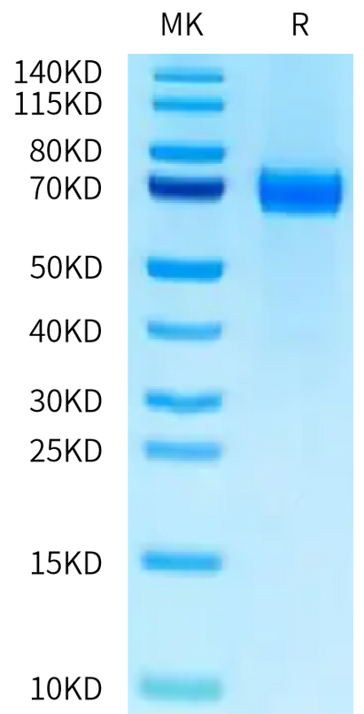 Mouse CD229 on Tris-Bis PAGE under reduced condition. The purity is greater than 95%.Recombinant Mouse CD229/SLAMF3 Protein