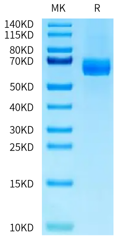 Human DLL4 on Tris-Bis PAGE under reduced condition. The purity is greater than 95%.Recombinant Human DLL4 Protein, Active