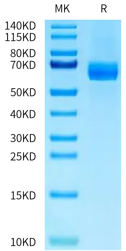 Human DLL4 on Tris-Bis PAGE under reduced condition. The purity is greater than 95%.Recombinant Human DLL4 Protein, Active