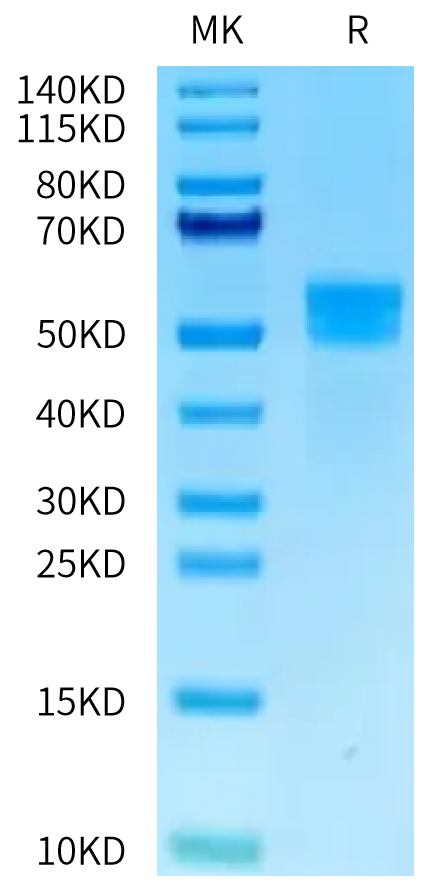 Human MSLN on Tris-Bis PAGE under reduced condition. The purity is greater than 95%.Recombinant Human MSLN/Mesothelin Protein, Active