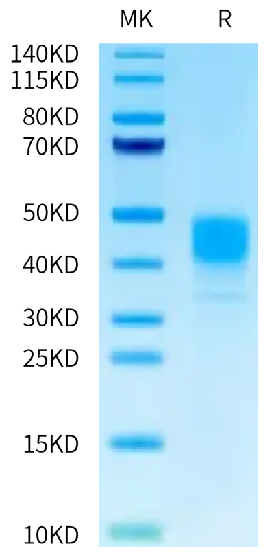 Human MSLN on Tris-Bis PAGE under reduced condition. The purity is greater than 95%.