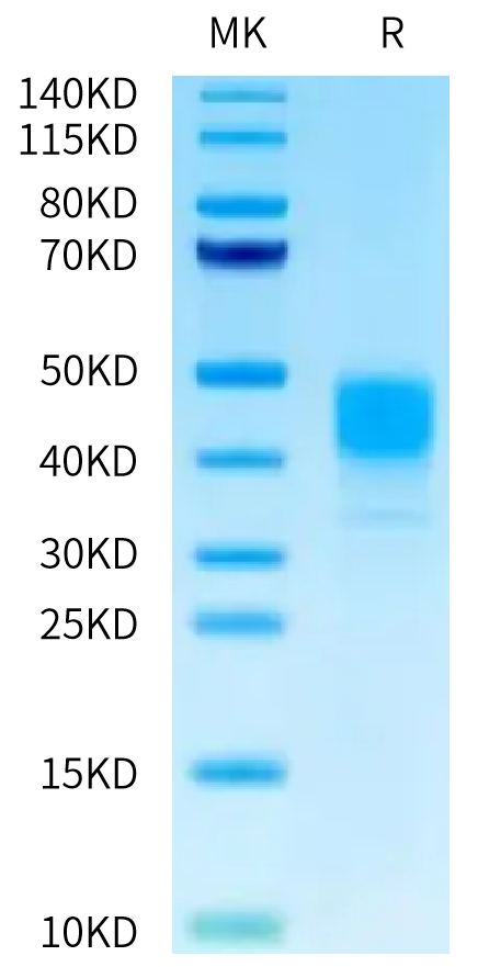 Human MSLN on Tris-Bis PAGE under reduced condition. The purity is greater than 95%.Recombinant Human MSLN/Mesothelin Protein, Active