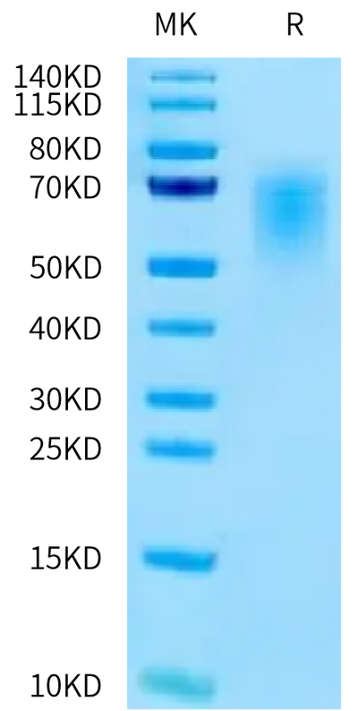 Human CEACAM-5 (145-322) on Tris-Bis PAGE under reduced condition. The purity is greater than 95%.Recombinant Human CEACAM-5/CD66e (145-322) Protein