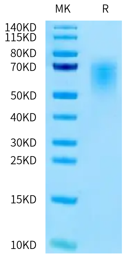 Human CEACAM-5 (145-322) on Tris-Bis PAGE under reduced condition. The purity is greater than 95%.Recombinant Human CEACAM-5/CD66e (145-322) Protein